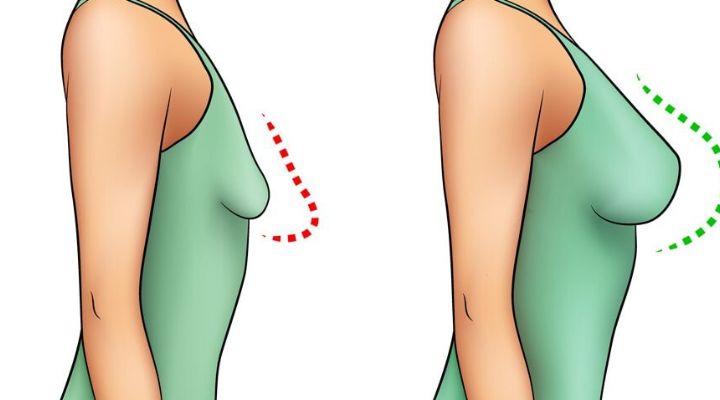 8 best tips to lift sagging breasts