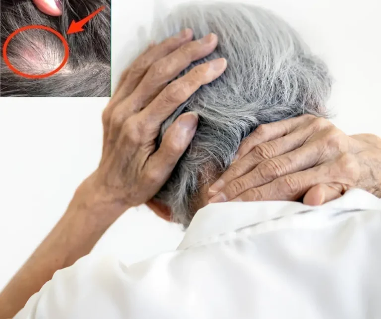It looks like a pimple on his head, but what they pulled out shocked them